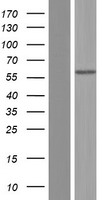 Western blot validation of overexpression lysate (Cat# LY433101) using anti-DDK antibody (Cat# TA50011-100). Left: Cell lysates from un-transfected HEK293T cells; Right: Cell lysates from HEK293T cells transfected with RC230101 using transfection reagent MegaTran 2.0 (Cat# TT210002).