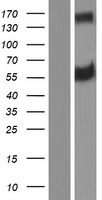 Western blot validation of overexpression lysate (Cat# LY426779) using anti-DDK antibody (Cat# TA50011-100). Left: Cell lysates from un-transfected HEK293T cells; Right: Cell lysates from HEK293T cells transfected with RC225768 using transfection reagent MegaTran 2.0 (Cat# TT210002).