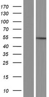 Western blot validation of overexpression lysate (Cat# LY428217) using anti-DDK antibody (Cat# TA50011-100). Left: Cell lysates from un-transfected HEK293T cells; Right: Cell lysates from HEK293T cells transfected with RC226601 using transfection reagent MegaTran 2.0 (Cat# TT210002).