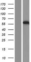 Western blot validation of overexpression lysate (Cat# LY423320) using anti-DDK antibody (Cat# TA50011-100). Left: Cell lysates from un-transfected HEK293T cells; Right: Cell lysates from HEK293T cells transfected with RC212660 using transfection reagent MegaTran 2.0 (Cat# TT210002).