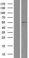 Western blot validation of overexpression lysate (Cat# LY416423) using anti-DDK antibody (Cat# TA50011-100). Left: Cell lysates from un-transfected HEK293T cells; Right: Cell lysates from HEK293T cells transfected with RC214702 using transfection reagent MegaTran 2.0 (Cat# TT210002).