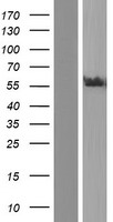 Western blot validation of overexpression lysate (Cat# LY426576) using anti-DDK antibody (Cat# TA50011-100). Left: Cell lysates from un-transfected HEK293T cells; Right: Cell lysates from HEK293T cells transfected with RC225817 using transfection reagent MegaTran 2.0 (Cat# TT210002).