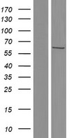 Western blot validation of overexpression lysate (Cat# LY434272) using anti-DDK antibody (Cat# TA50011-100). Left: Cell lysates from un-transfected HEK293T cells; Right: Cell lysates from HEK293T cells transfected with RC231273 using transfection reagent MegaTran 2.0 (Cat# TT210002).