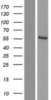Western blot validation of overexpression lysate (Cat# LY431436) using anti-DDK antibody (Cat# TA50011-100). Left: Cell lysates from un-transfected HEK293T cells; Right: Cell lysates from HEK293T cells transfected with RC228408 using transfection reagent MegaTran 2.0 (Cat# TT210002).