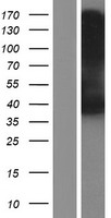 Western blot validation of overexpression lysate (Cat# LY428794) using anti-DDK antibody (Cat# TA50011-100). Left: Cell lysates from un-transfected HEK293T cells; Right: Cell lysates from HEK293T cells transfected with RC227127 using transfection reagent MegaTran 2.0 (Cat# TT210002).