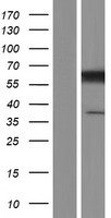 Western blot validation of overexpression lysate (Cat# LY423380) using anti-DDK antibody (Cat# TA50011-100). Left: Cell lysates from un-transfected HEK293T cells; Right: Cell lysates from HEK293T cells transfected with RC216100 using transfection reagent MegaTran 2.0 (Cat# TT210002).