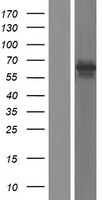 Western blot validation of overexpression lysate (Cat# LY428913) using anti-DDK antibody (Cat# TA50011-100). Left: Cell lysates from un-transfected HEK293T cells; Right: Cell lysates from HEK293T cells transfected with RC227228 using transfection reagent MegaTran 2.0 (Cat# TT210002).