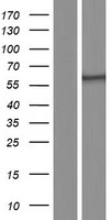 Western blot validation of overexpression lysate (Cat# LY434266) using anti-DDK antibody (Cat# TA50011-100). Left: Cell lysates from un-transfected HEK293T cells; Right: Cell lysates from HEK293T cells transfected with RC231267 using transfection reagent MegaTran 2.0 (Cat# TT210002).