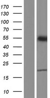 Western blot validation of overexpression lysate (Cat# LY411109) using anti-DDK antibody (Cat# TA50011-100). Left: Cell lysates from un-transfected HEK293T cells; Right: Cell lysates from HEK293T cells transfected with RC218595 using transfection reagent MegaTran 2.0 (Cat# TT210002).