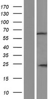Western blot validation of overexpression lysate (Cat# LY431468) using anti-DDK antibody (Cat# TA50011-100). Left: Cell lysates from un-transfected HEK293T cells; Right: Cell lysates from HEK293T cells transfected with RC228440 using transfection reagent MegaTran 2.0 (Cat# TT210002).