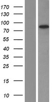 Western blot validation of overexpression lysate (Cat# LY417016) using anti-DDK antibody (Cat# TA50011-100). Left: Cell lysates from un-transfected HEK293T cells; Right: Cell lysates from HEK293T cells transfected with RC222649 using transfection reagent MegaTran 2.0 (Cat# TT210002).
