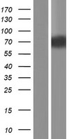 Western blot validation of overexpression lysate (Cat# LY404615) using anti-DDK antibody (Cat# TA50011-100). Left: Cell lysates from un-transfected HEK293T cells; Right: Cell lysates from HEK293T cells transfected with RC222607 using transfection reagent MegaTran 2.0 (Cat# TT210002).