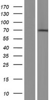 Western blot validation of overexpression lysate (Cat# LY434319) using anti-DDK antibody (Cat# TA50011-100). Left: Cell lysates from un-transfected HEK293T cells; Right: Cell lysates from HEK293T cells transfected with RC231320 using transfection reagent MegaTran 2.0 (Cat# TT210002).