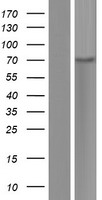 Western blot validation of overexpression lysate (Cat# LY434325) using anti-DDK antibody (Cat# TA50011-100). Left: Cell lysates from un-transfected HEK293T cells; Right: Cell lysates from HEK293T cells transfected with RC231326 using transfection reagent MegaTran 2.0 (Cat# TT210002).