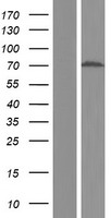 Western blot validation of overexpression lysate (Cat# LY432321) using anti-DDK antibody (Cat# TA50011-100). Left: Cell lysates from un-transfected HEK293T cells; Right: Cell lysates from HEK293T cells transfected with RC229304 using transfection reagent MegaTran 2.0 (Cat# TT210002).