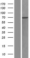 Western blot validation of overexpression lysate (Cat# LY431533) using anti-DDK antibody (Cat# TA50011-100). Left: Cell lysates from un-transfected HEK293T cells; Right: Cell lysates from HEK293T cells transfected with RC228505 using transfection reagent MegaTran 2.0 (Cat# TT210002).