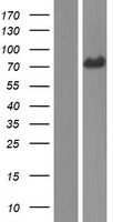Western blot validation of overexpression lysate (Cat# LY426357) using anti-DDK antibody (Cat# TA50011-100). Left: Cell lysates from un-transfected HEK293T cells; Right: Cell lysates from HEK293T cells transfected with RC226030 using transfection reagent MegaTran 2.0 (Cat# TT210002).