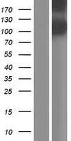 Western blot validation of overexpression lysate (Cat# LY428283) using anti-DDK antibody (Cat# TA50011-100). Left: Cell lysates from un-transfected HEK293T cells; Right: Cell lysates from HEK293T cells transfected with RC227787 using transfection reagent MegaTran 2.0 (Cat# TT210002).