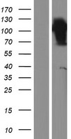 Western blot validation of overexpression lysate (Cat# LY421766) using anti-DDK antibody (Cat# TA50011-100). Left: Cell lysates from un-transfected HEK293T cells; Right: Cell lysates from HEK293T cells transfected with RC213021 using transfection reagent MegaTran 2.0 (Cat# TT210002).