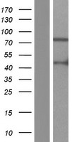 Western blot validation of overexpression lysate (Cat# LY421604) using anti-DDK antibody (Cat# TA50011-100). Left: Cell lysates from un-transfected HEK293T cells; Right: Cell lysates from HEK293T cells transfected with RC211794 using transfection reagent MegaTran 2.0 (Cat# TT210002).