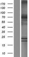 Western blot validation of overexpression lysate (Cat# LY433385) using anti-DDK antibody (Cat# TA50011-100). Left: Cell lysates from un-transfected HEK293T cells; Right: Cell lysates from HEK293T cells transfected with RC230385 using transfection reagent MegaTran 2.0 (Cat# TT210002).