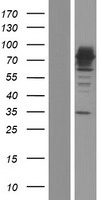 Western blot validation of overexpression lysate (Cat# LY422018) using anti-DDK antibody (Cat# TA50011-100). Left: Cell lysates from un-transfected HEK293T cells; Right: Cell lysates from HEK293T cells transfected with RC214018 using transfection reagent MegaTran 2.0 (Cat# TT210002).