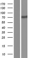 Western blot validation of overexpression lysate (Cat# LY431547) using anti-DDK antibody (Cat# TA50011-100). Left: Cell lysates from un-transfected HEK293T cells; Right: Cell lysates from HEK293T cells transfected with RC228519 using transfection reagent MegaTran 2.0 (Cat# TT210002).