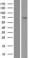 Western blot validation of overexpression lysate (Cat# LY434354) using anti-DDK antibody (Cat# TA50011-100). Left: Cell lysates from un-transfected HEK293T cells; Right: Cell lysates from HEK293T cells transfected with RC231355 using transfection reagent MegaTran 2.0 (Cat# TT210002).