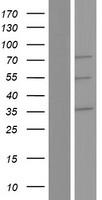 Western blot validation of overexpression lysate (Cat# LY413395) using anti-DDK antibody (Cat# TA50011-100). Left: Cell lysates from un-transfected HEK293T cells; Right: Cell lysates from HEK293T cells transfected with RC212979 using transfection reagent MegaTran 2.0 (Cat# TT210002).