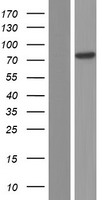 Western blot validation of overexpression lysate (Cat# LY428247) using anti-DDK antibody (Cat# TA50011-100). Left: Cell lysates from un-transfected HEK293T cells; Right: Cell lysates from HEK293T cells transfected with RC227904 using transfection reagent MegaTran 2.0 (Cat# TT210002).