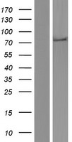 Western blot validation of overexpression lysate (Cat# LY434365) using anti-DDK antibody (Cat# TA50011-100). Left: Cell lysates from un-transfected HEK293T cells; Right: Cell lysates from HEK293T cells transfected with RC231366 using transfection reagent MegaTran 2.0 (Cat# TT210002).