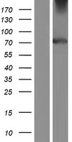 Western blot validation of overexpression lysate (Cat# LY423487) using anti-DDK antibody (Cat# TA50011-100). Left: Cell lysates from un-transfected HEK293T cells; Right: Cell lysates from HEK293T cells transfected with RC217348 using transfection reagent MegaTran 2.0 (Cat# TT210002).