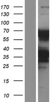 Western blot validation of overexpression lysate (Cat# LY404719) using anti-DDK antibody (Cat# TA50011-100). Left: Cell lysates from un-transfected HEK293T cells; Right: Cell lysates from HEK293T cells transfected with RC220857 using transfection reagent MegaTran 2.0 (Cat# TT210002).