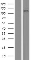 Western blot validation of overexpression lysate (Cat# LY414777) using anti-DDK antibody (Cat# TA50011-100). Left: Cell lysates from un-transfected HEK293T cells; Right: Cell lysates from HEK293T cells transfected with RC216867 using transfection reagent MegaTran 2.0 (Cat# TT210002).