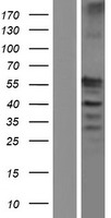 Western blot validation of overexpression lysate (Cat# LY406246) using anti-DDK antibody (Cat# TA50011-100). Left: Cell lysates from un-transfected HEK293T cells; Right: Cell lysates from HEK293T cells transfected with RC206959 using transfection reagent MegaTran 2.0 (Cat# TT210002).