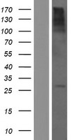 Western blot validation of overexpression lysate (Cat# LY428307) using anti-DDK antibody (Cat# TA50011-100). Left: Cell lysates from un-transfected HEK293T cells; Right: Cell lysates from HEK293T cells transfected with RC226585 using transfection reagent MegaTran 2.0 (Cat# TT210002).