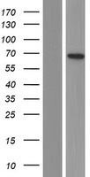 Western blot validation of overexpression lysate (Cat# LY407398) using anti-DDK antibody (Cat# TA50011-100). Left: Cell lysates from un-transfected HEK293T cells; Right: Cell lysates from HEK293T cells transfected with RC210067 using transfection reagent MegaTran 2.0 (Cat# TT210002).