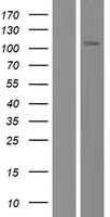 Western blot validation of overexpression lysate (Cat# LY410281) using anti-DDK antibody (Cat# TA50011-100). Left: Cell lysates from un-transfected HEK293T cells; Right: Cell lysates from HEK293T cells transfected with RC219650 using transfection reagent MegaTran 2.0 (Cat# TT210002).
