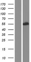 Western blot validation of overexpression lysate (Cat# LY431917) using anti-DDK antibody (Cat# TA50011-100). Left: Cell lysates from un-transfected HEK293T cells; Right: Cell lysates from HEK293T cells transfected with RC228889 using transfection reagent MegaTran 2.0 (Cat# TT210002).