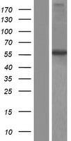 Western blot validation of overexpression lysate (Cat# LY421966) using anti-DDK antibody (Cat# TA50011-100). Left: Cell lysates from un-transfected HEK293T cells; Right: Cell lysates from HEK293T cells transfected with RC211008 using transfection reagent MegaTran 2.0 (Cat# TT210002).