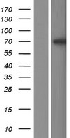 Western blot validation of overexpression lysate (Cat# LY406618) using anti-DDK antibody (Cat# TA50011-100). Left: Cell lysates from un-transfected HEK293T cells; Right: Cell lysates from HEK293T cells transfected with RC206958 using transfection reagent MegaTran 2.0 (Cat# TT210002).