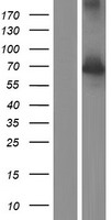 Western blot validation of overexpression lysate (Cat# LY420497) using anti-DDK antibody (Cat# TA50011-100). Left: Cell lysates from un-transfected HEK293T cells; Right: Cell lysates from HEK293T cells transfected with RC217427 using transfection reagent MegaTran 2.0 (Cat# TT210002).