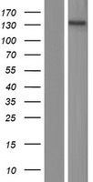 Western blot validation of overexpression lysate (Cat# LY414897) using anti-DDK antibody (Cat# TA50011-100). Left: Cell lysates from un-transfected HEK293T cells; Right: Cell lysates from HEK293T cells transfected with RC218402 using transfection reagent MegaTran 2.0 (Cat# TT210002).