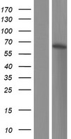 Western blot validation of overexpression lysate (Cat# LY431963) using anti-DDK antibody (Cat# TA50011-100). Left: Cell lysates from un-transfected HEK293T cells; Right: Cell lysates from HEK293T cells transfected with RC228935 using transfection reagent MegaTran 2.0 (Cat# TT210002).