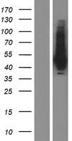 Western blot validation of overexpression lysate (Cat# LY433000) using anti-DDK antibody (Cat# TA50011-100). Left: Cell lysates from un-transfected HEK293T cells; Right: Cell lysates from HEK293T cells transfected with RC230000 using transfection reagent MegaTran 2.0 (Cat# TT210002).
