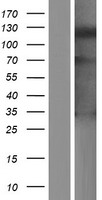 Western blot validation of overexpression lysate (Cat# LY427046) using anti-DDK antibody (Cat# TA50011-100). Left: Cell lysates from un-transfected HEK293T cells; Right: Cell lysates from HEK293T cells transfected with RC226257 using transfection reagent MegaTran 2.0 (Cat# TT210002).