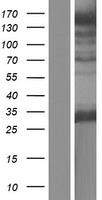 Western blot validation of overexpression lysate (Cat# LY412585) using anti-DDK antibody (Cat# TA50011-100). Left: Cell lysates from un-transfected HEK293T cells; Right: Cell lysates from HEK293T cells transfected with RC212897 using transfection reagent MegaTran 2.0 (Cat# TT210002).