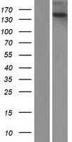 Western blot validation of overexpression lysate (Cat# LY433686) using anti-DDK antibody (Cat# TA50011-100). Left: Cell lysates from un-transfected HEK293T cells; Right: Cell lysates from HEK293T cells transfected with RC230687 using transfection reagent MegaTran 2.0 (Cat# TT210002).