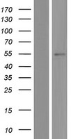Western blot validation of overexpression lysate (Cat# LY409194) using anti-DDK antibody (Cat# TA50011-100). Left: Cell lysates from un-transfected HEK293T cells; Right: Cell lysates from HEK293T cells transfected with RC213006 using transfection reagent MegaTran 2.0 (Cat# TT210002).