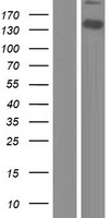Western blot validation of overexpression lysate (Cat# LY410950) using anti-DDK antibody (Cat# TA50011-100). Left: Cell lysates from un-transfected HEK293T cells; Right: Cell lysates from HEK293T cells transfected with RC213814 using transfection reagent MegaTran 2.0 (Cat# TT210002).